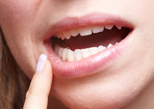 20 марта–Всемирный день здоровья полости рта