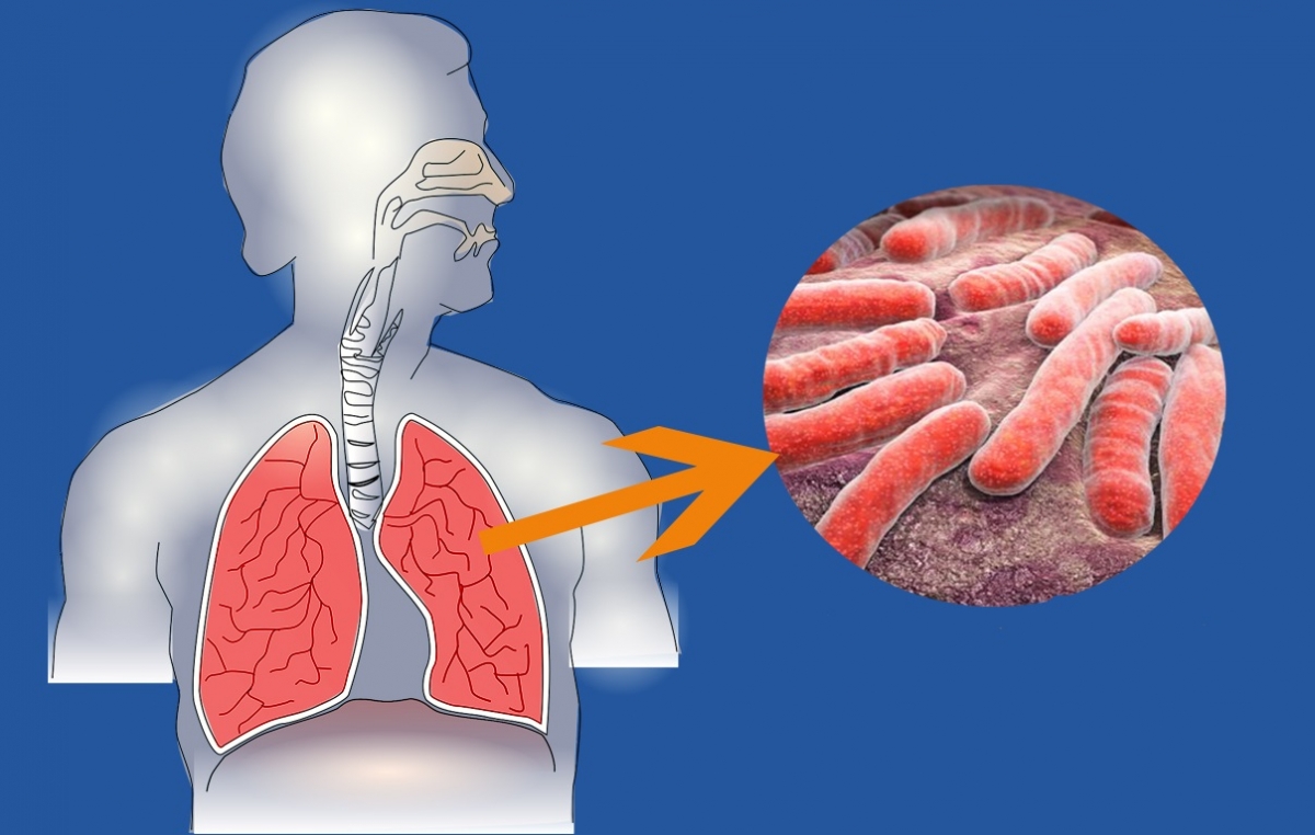 Районная информационная акция «Жизнь без туберкулеза»