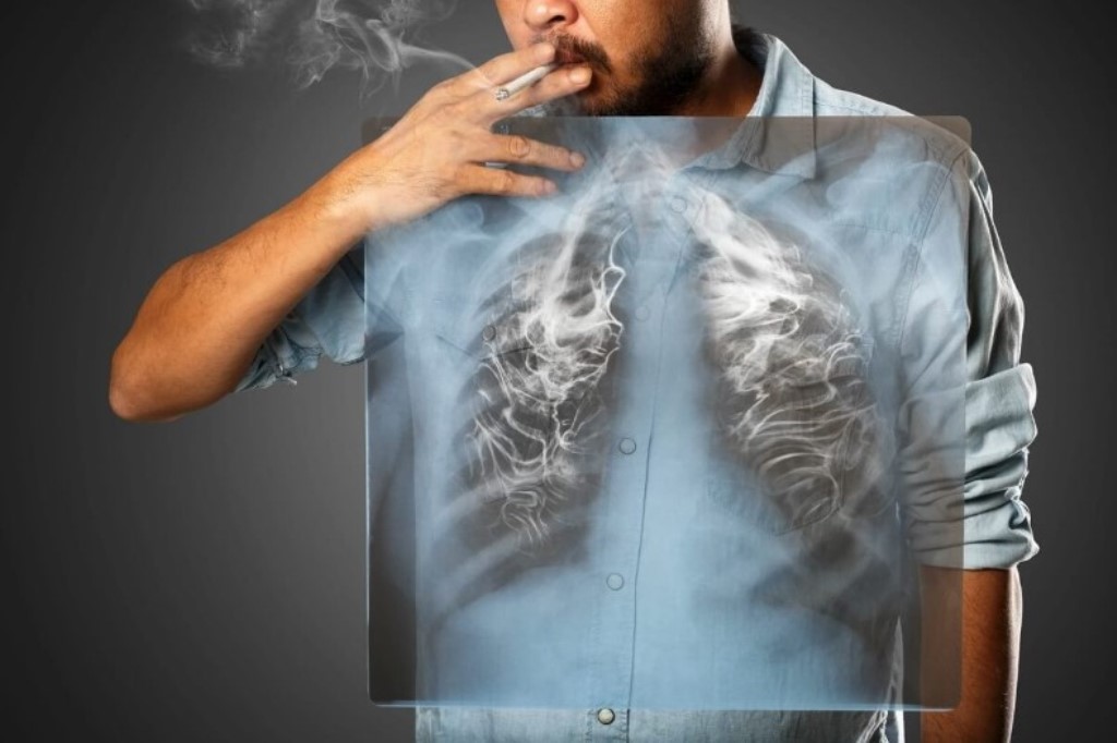Курение и рак: смертельная связь